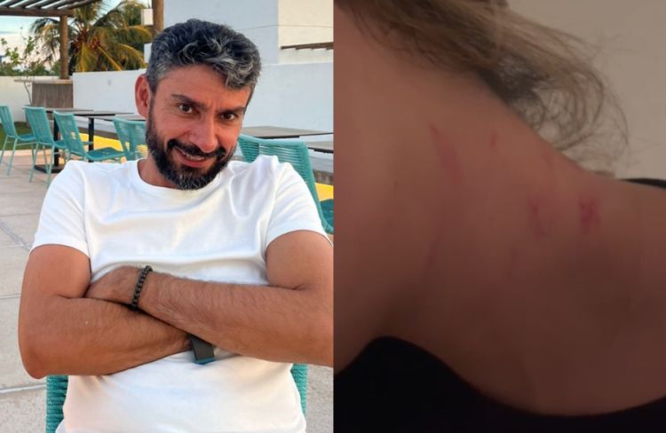 Corretora de Imóveis registra ocorrência por agressão em hotel de Barra Grande